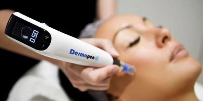 Close-up of a facial treatment with a Dermapen device.