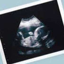 2D Ultrasound