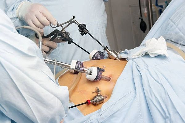 Best Laparoscopic Surgeon Near Me