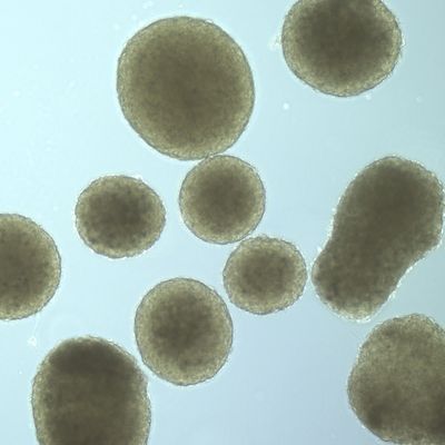 Cluster of round and irregular-shaped cell masses under a microscope.