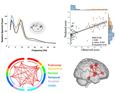 EEG-analysis