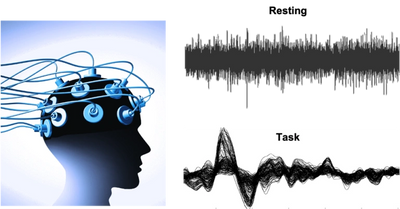 EEG-recording