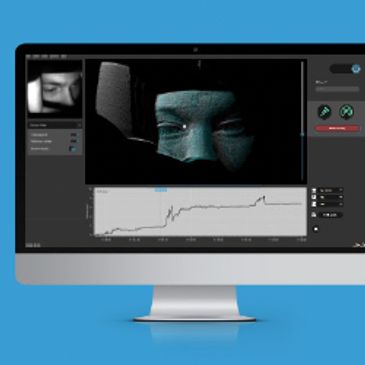 MRI-Motion-tracking