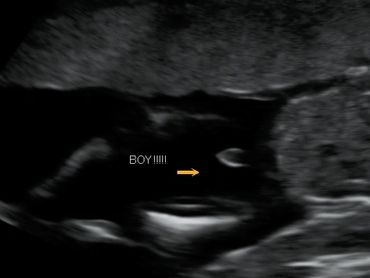 2D Ultrasound picture of a baby BOY all stretched out, at exactly 26 weeks pregnant.