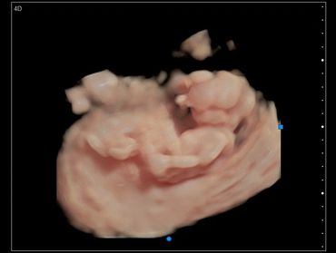 3D Ultrasound picture in Virtual HD of baby all stretched out, at exactly 26 weeks pregnant.
