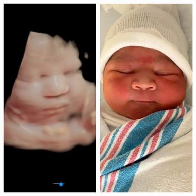 Amazing Before and After Pictures of babies' ultrasounds, and birth day pictures!