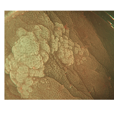 Close-up of textured surface with clustered formations.