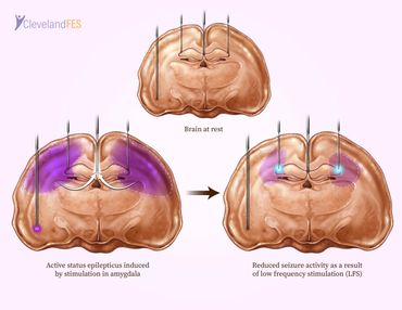 Status Epilepticus Induction and Inhibition