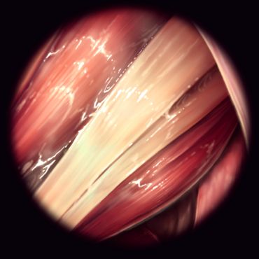 Muscle and Tendon Study