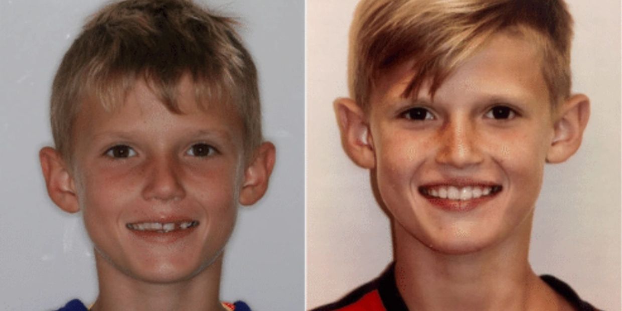 myofunctional therapy in Louisville, KY