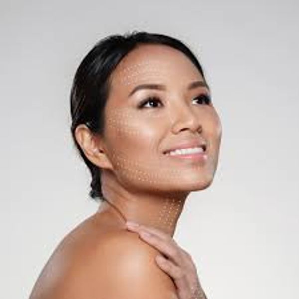 Non Surgical Face Lift treatment