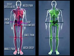 Plantar Fasciitis, Neuropathy, Leg Cramps, Hip Pain, Diabetes, Back Pain, Arthritis, Restless Legs