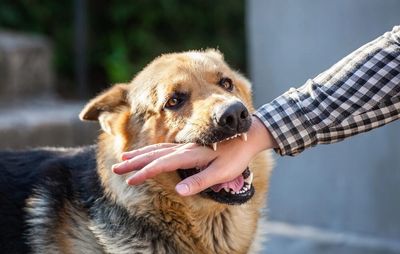 Aggressive dog biting a person's arm, dog bite injury in Encino
