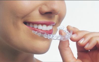 Clear Aligners - Dr. Jennifer H Yau - Family Orthodontist in Los Gatos, Campbell, and San Jose
