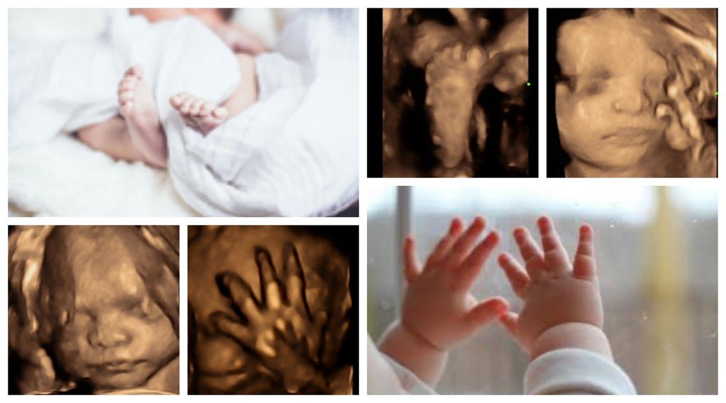 3D and 4D ultrasound images and picture keepsakes