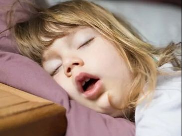 A young child sleeping peacefully with mouth slightly open.