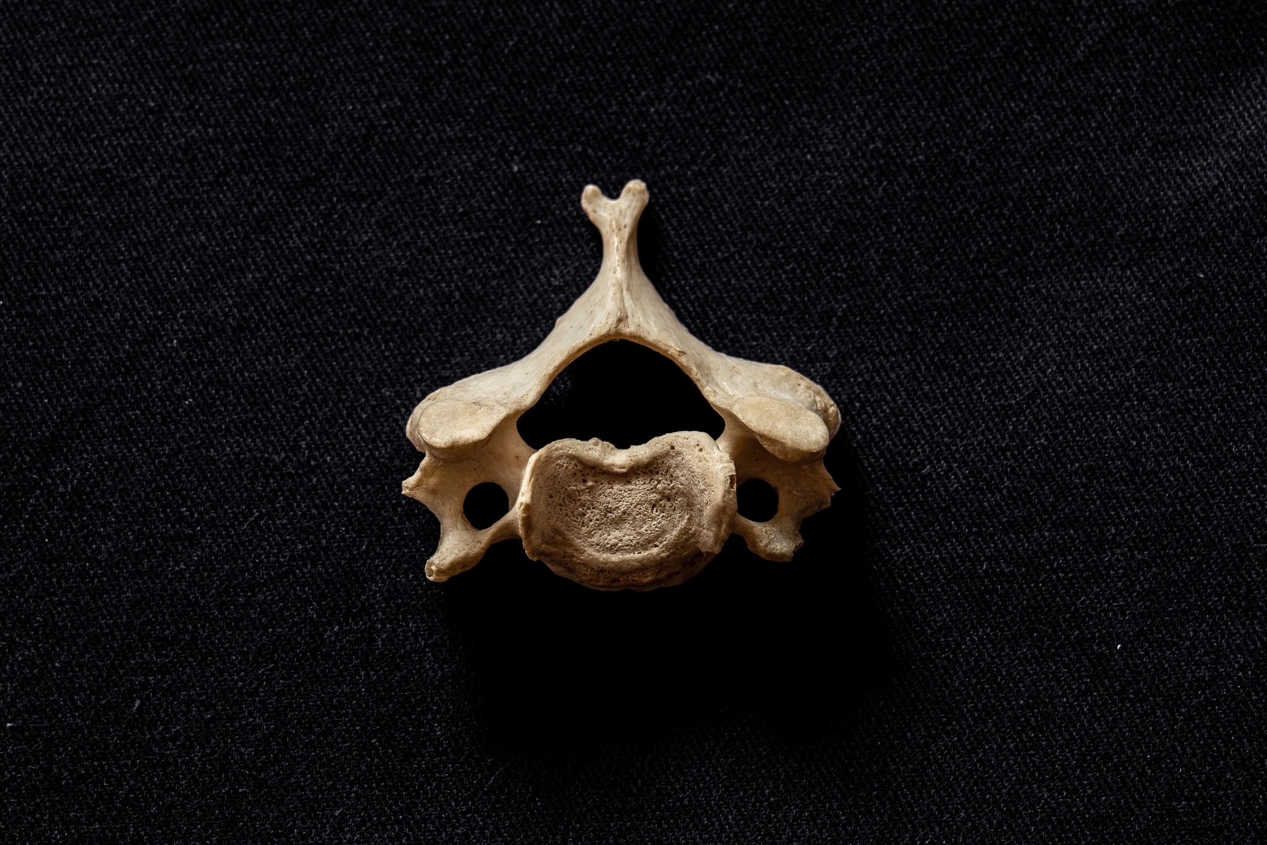 Cervical Spine Vertebra 