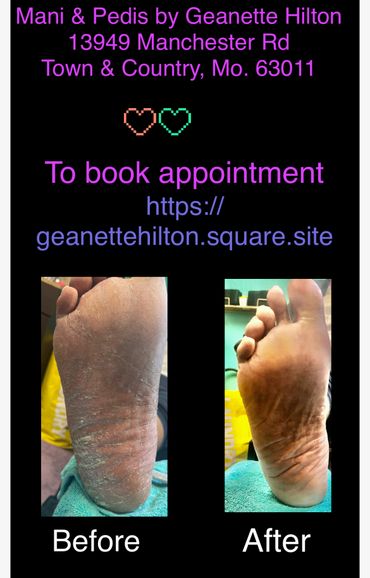 Before and after foot care showing smoother skin after treatment.