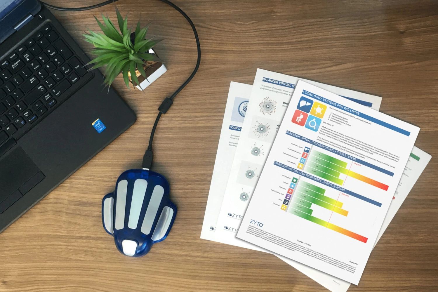 Laptop met een blauw apparaat en papieren rapport op een houten bureau.