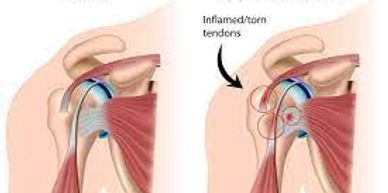 60 Pain Relief and foot and leg rub quarter of  each together rub on the product morning and night