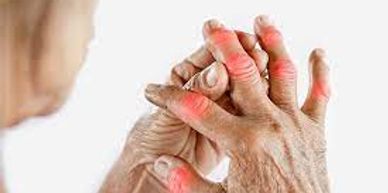 Apply 60 Second Pain Relief on the affected area .