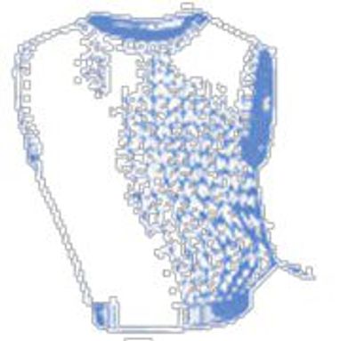 Microscopic view of fascia tissue