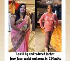 Mrs. Nidhi reduced her 11kg weight In 2 months, reduced PCOS symptoms and improved her overall healt