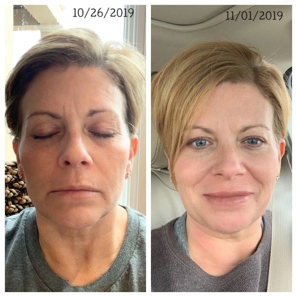 What a difference CHEEKS make!