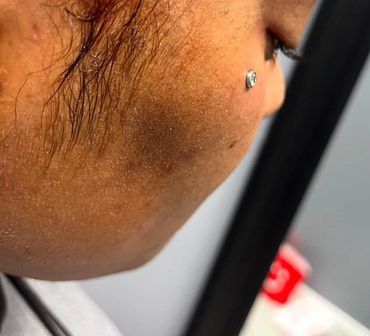 dermal piercing done professionally in fort myers