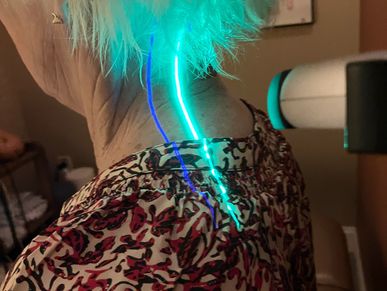 green violet laser cold therapy laser treatment healing