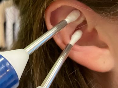 weight loss no medication electrical acupuncutre natural