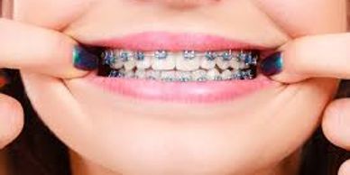 Brackets