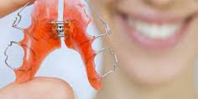 Paladares y Brackets
