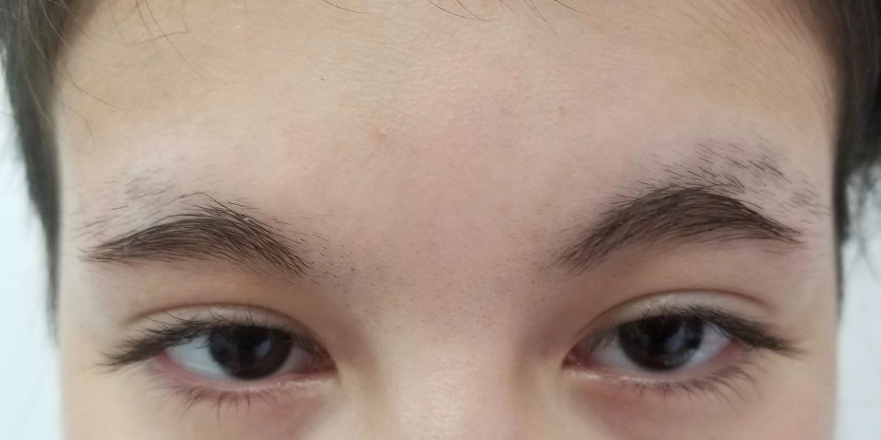 The danger of eyebrow razor tinkle eyebrow shaving, the use of eyebrow razor, razor off my eyebrows