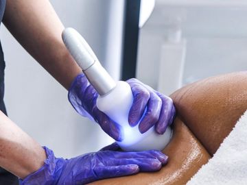 Cryo Brazilian Butt Lift