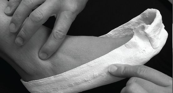 A chiropodist's hands, making a plaster cast of a foot for orthotics.