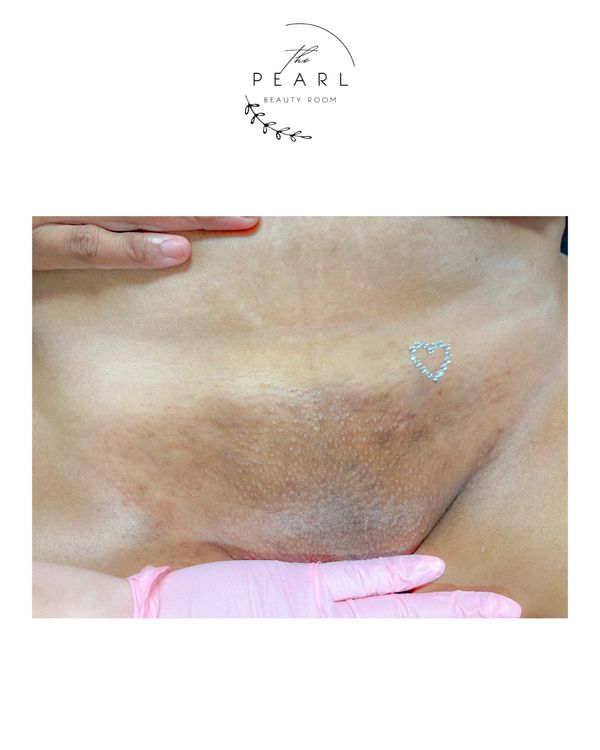 Brazilian + Vajazzle