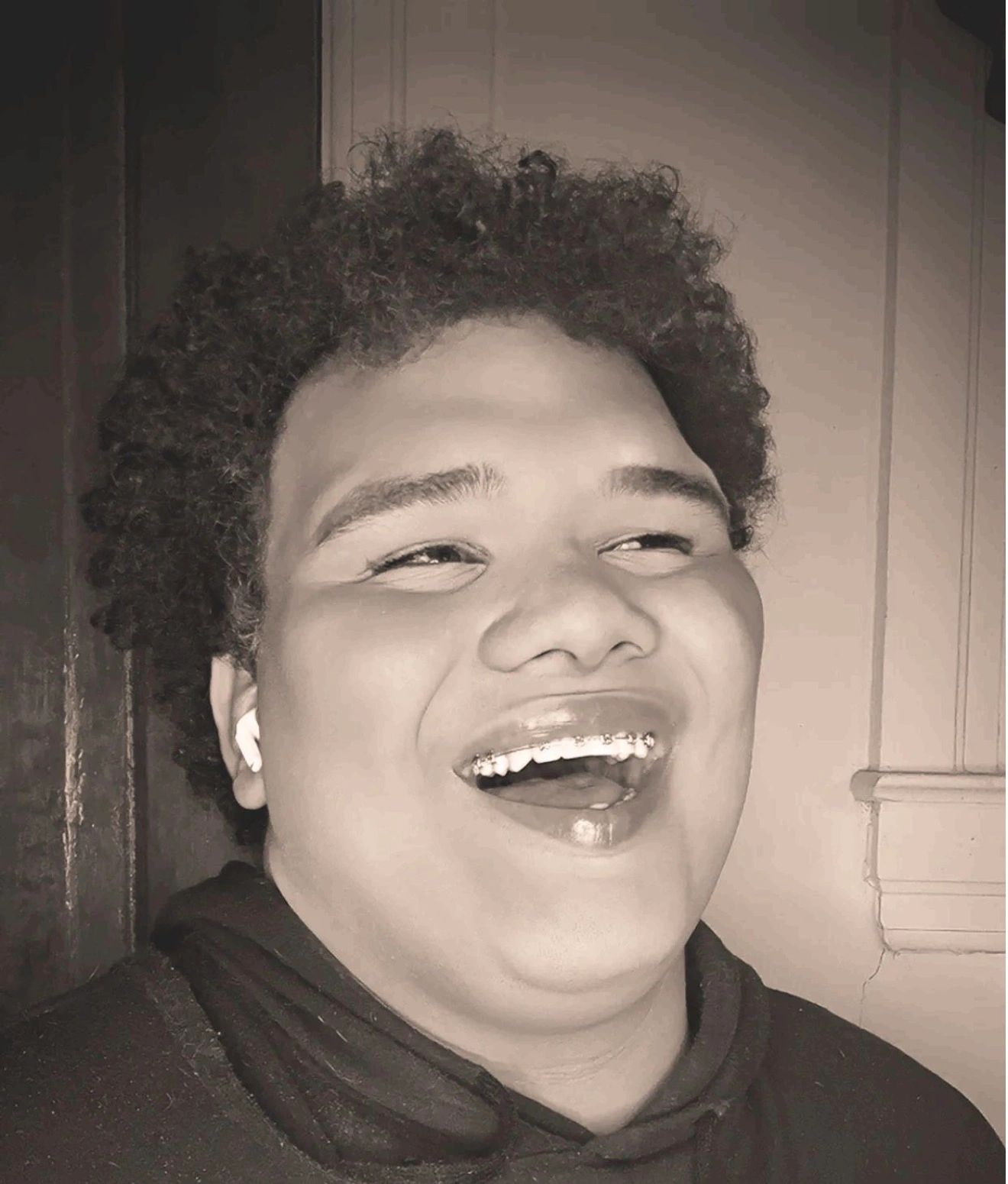 A person laughing joyfully with braces and AirPods.