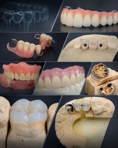 Various dental prosthetics and restorations on models.