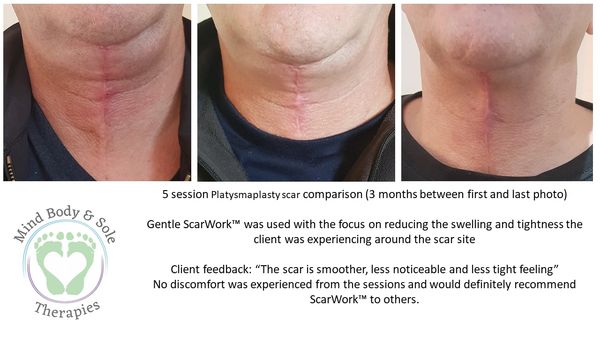 Facial ScarWork photos