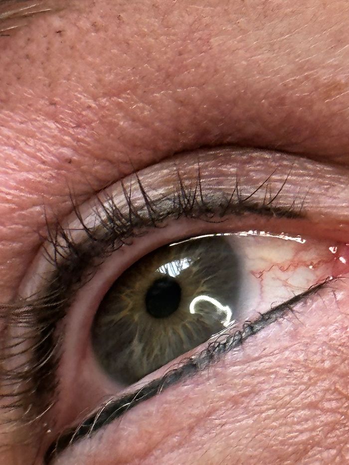 Permanent top and bottom eyeliner