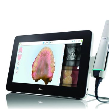 Digital dental scanner displaying a 3D model of the upper jaw on screen.