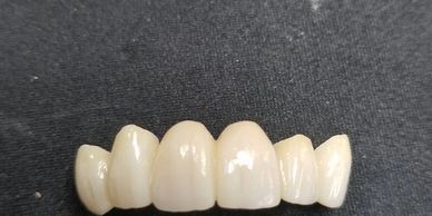 Dentsply sirona Temmp PMMA crowns and bridge .we are Dentsply sirona cerec certified dental Laborato