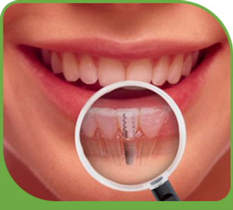 Cosmetic Dentisty and Implants in Aurora and Newmarket