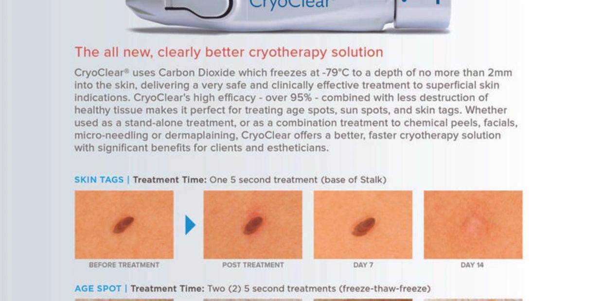 How to use CryoClear Guide