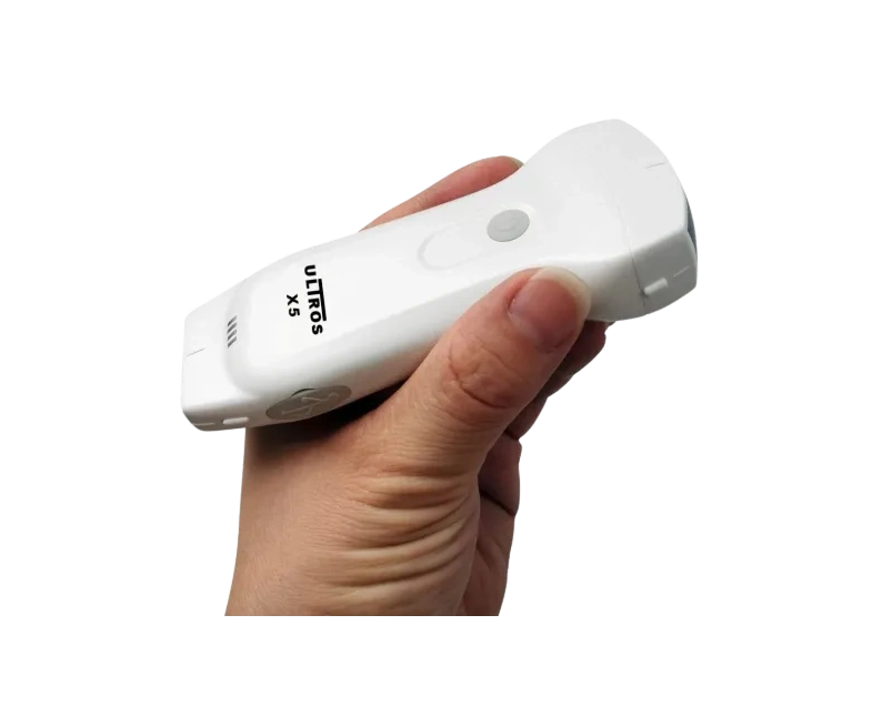 Ultros X5 Ultrasound