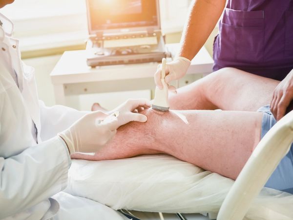 Ultrasound-guided platelet-rich plasma injection of the knee
