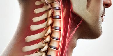 Image of whiplash and neck pain