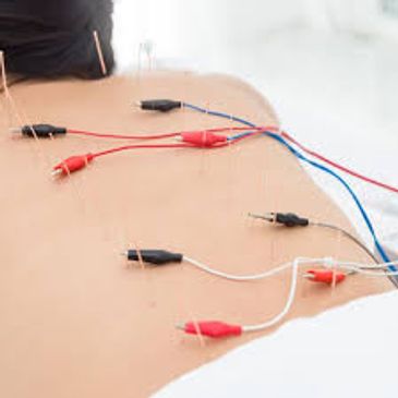 Electric nodes