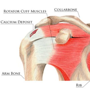 Rotator Cuff image